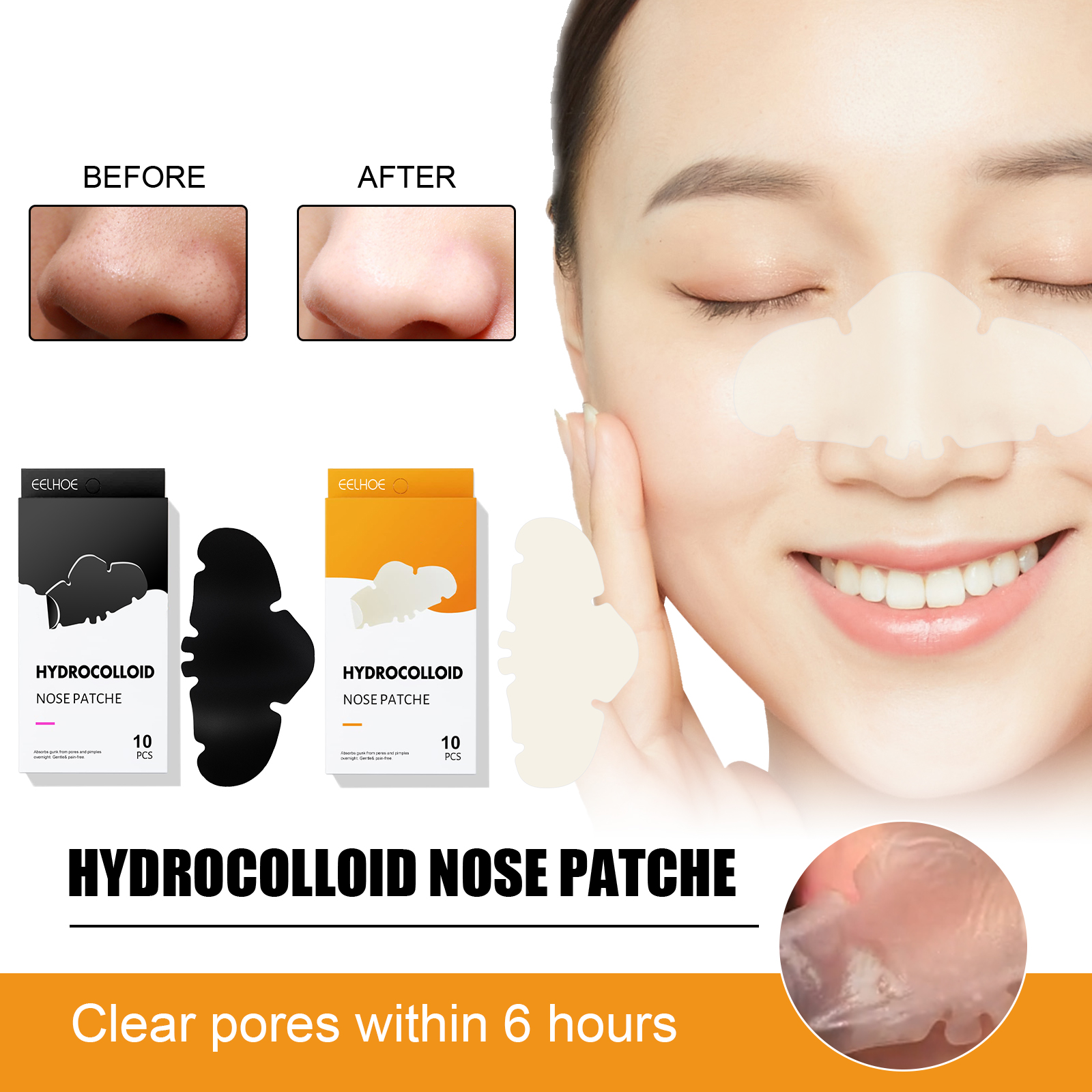 Blackhead Nipper - Hyaluronic  - Skincare Oily Skin ulasan dan harga